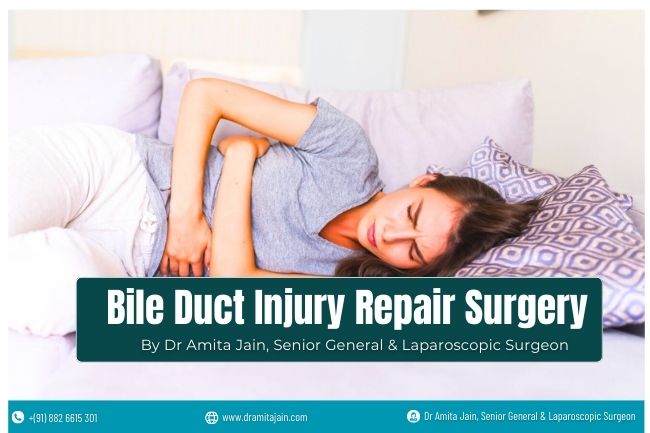 Bile Duct Injury Repair Surgery by Dr Amita Jain